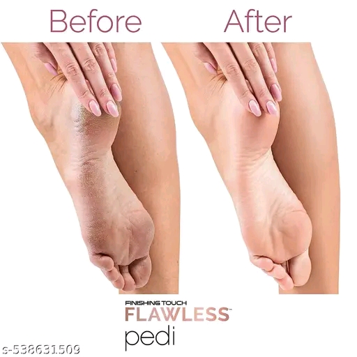 Callus Remover Rechargeable Electric Tool for an/ at-Home Spa Pedicure Experience - Removes Dry Skin for Smoother Feet - Image 4